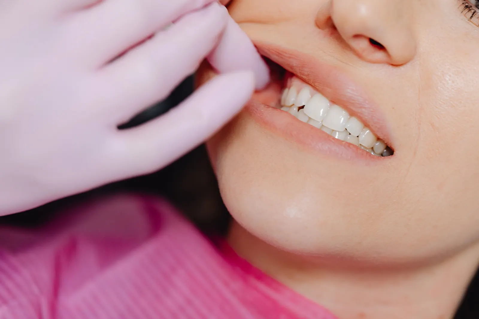 blog hero no prep veneers ultra thin turkey guide 1