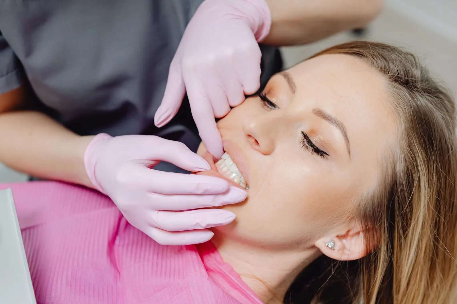 blog hero no prep veneers ultra thin turkey guide 2