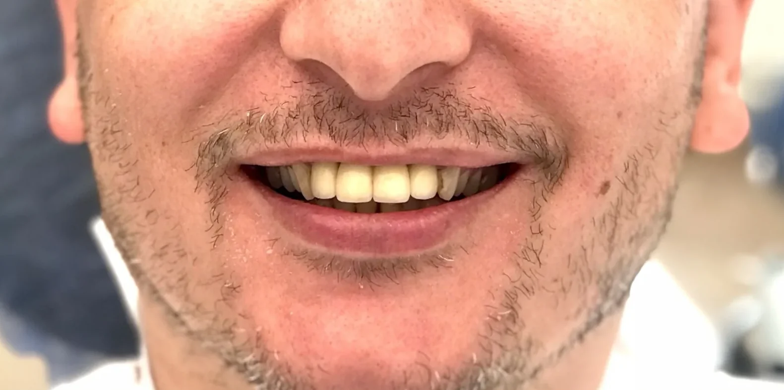 Before